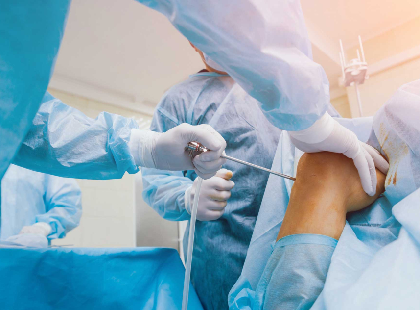 Knee Arthroscopic Surgery – totalkneesolutions.com